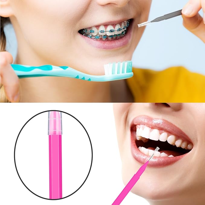 Patelai 100 Pieces Braces Brush for Cleaner Interdental Brush Toothpick Dental Tooth Flossing Head Oral Dental Hygiene Flosser Toothpick Cleaners Tooth Cleaning Tool(Pink, Grey,Ideal Size)