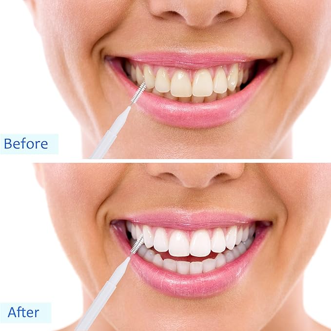 Patelai 50 Pieces Interdental Brush for Cleaner Braces Brush Toothpick Dental Tooth Flossing Head Oral Dental Hygiene Flosser Toothpick Cleaners Tooth Cleaning Tool(Black, White, Gray)