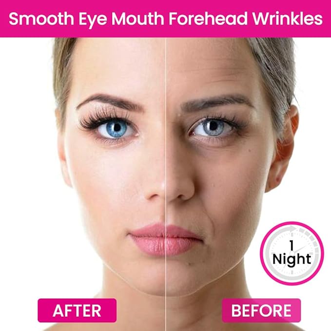 Kaely Wrinkle Patches for Face Overnight, Silicone Scar Tape for Wrinkles Forehead, Smile Line, Face Tape for Wrinkles Overnight Sleeping Lifting Sagging Skin, 192 Pcs (12 Sheets of 16 Patches)