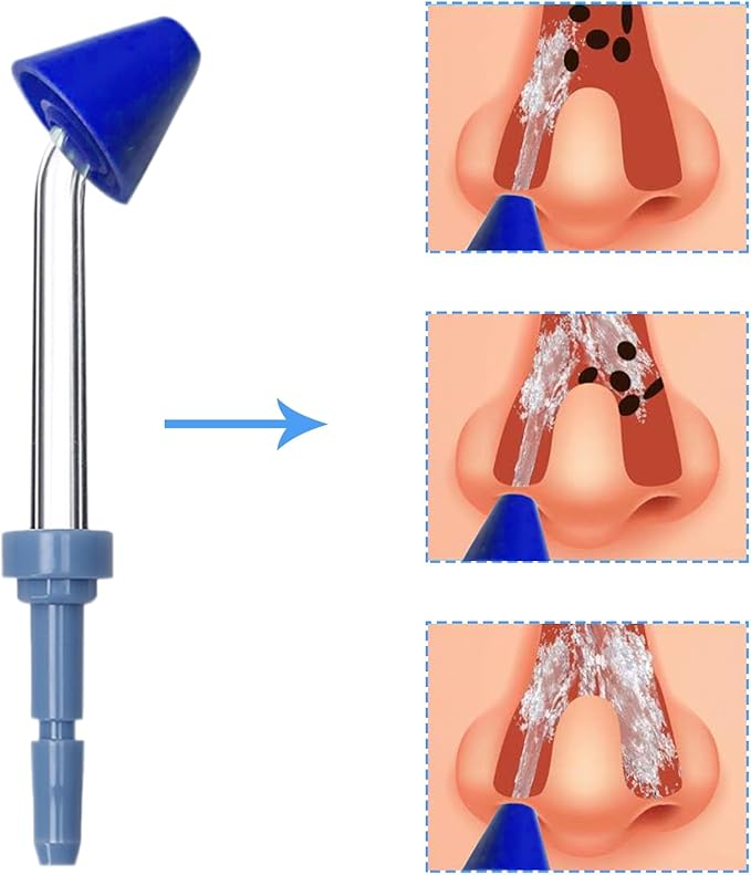 Nose Washing Replacement Tips for Waterpik Oral Irrigator Wp-100 Wp-450 Wp-250 Wp-300 Wp-660 Wp-900 by (6 Nasal irrigator Tips)