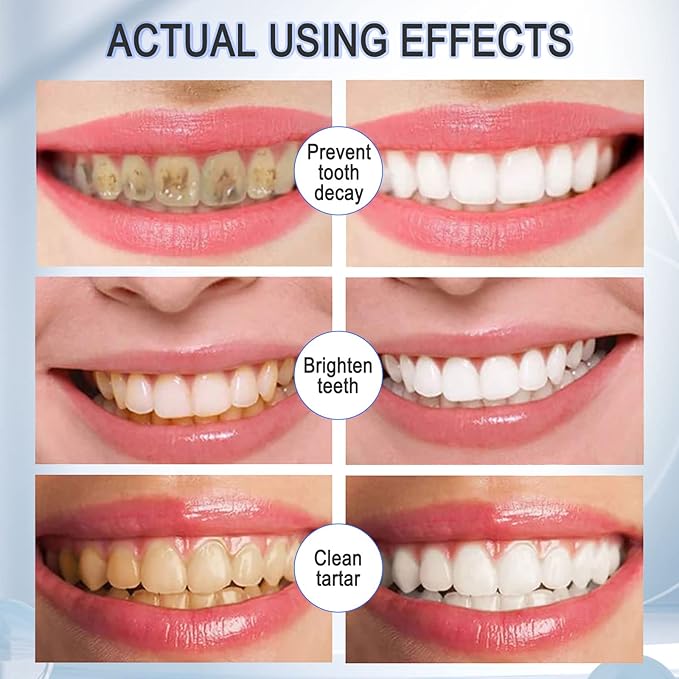 Teeth Whitening Toothpaste with Fluoride, Mousse Foam Toothpaste, 2 Pack Foam Toothpaste for U-Shape Electric Toothbrush, Oral Care-Toothpaste Replacement Natural Mouth Wash Water