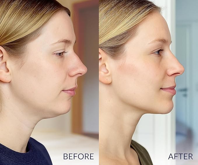 Stylia V Line Lifting Collagen Mask - Lift, Firm & Contour Jawline - Tightening Double Chin Strap with Hyaluronic Acid & Aloe - Neck Lift & Face Tightening Mask - Jawline Shaper Face Lift Tape (5PC)