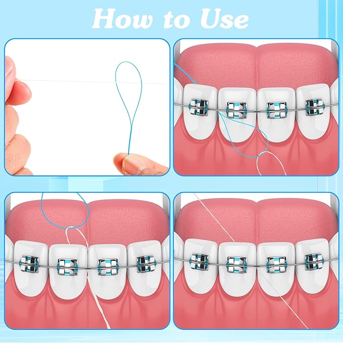 Vesici 600 Pcs Dental Floss Threader for Bridges, Braces, and Implants Dental Threader, Multifunctional Nylon Loop Design for Your Teeth, Pack of 12(Blue and Green)