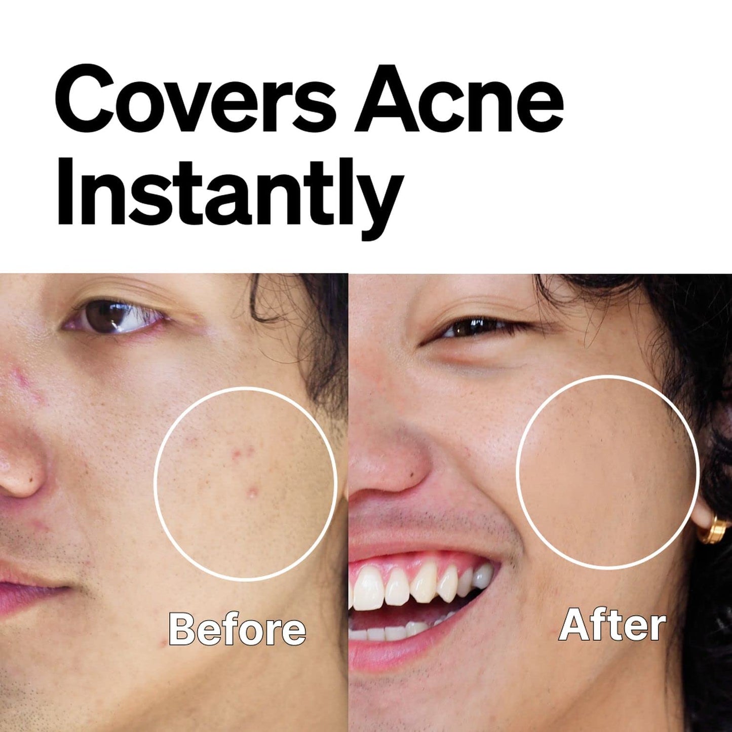 FRONTMAN Fade, Men's Acne Concealer With Salicylic Acid | Blemishes & Dark Circles | Natural Coverage, Non-Greasy Formula, Fragrance-Free | Great for All Skin Types | Men’s Concealer M1 Medium Shade
