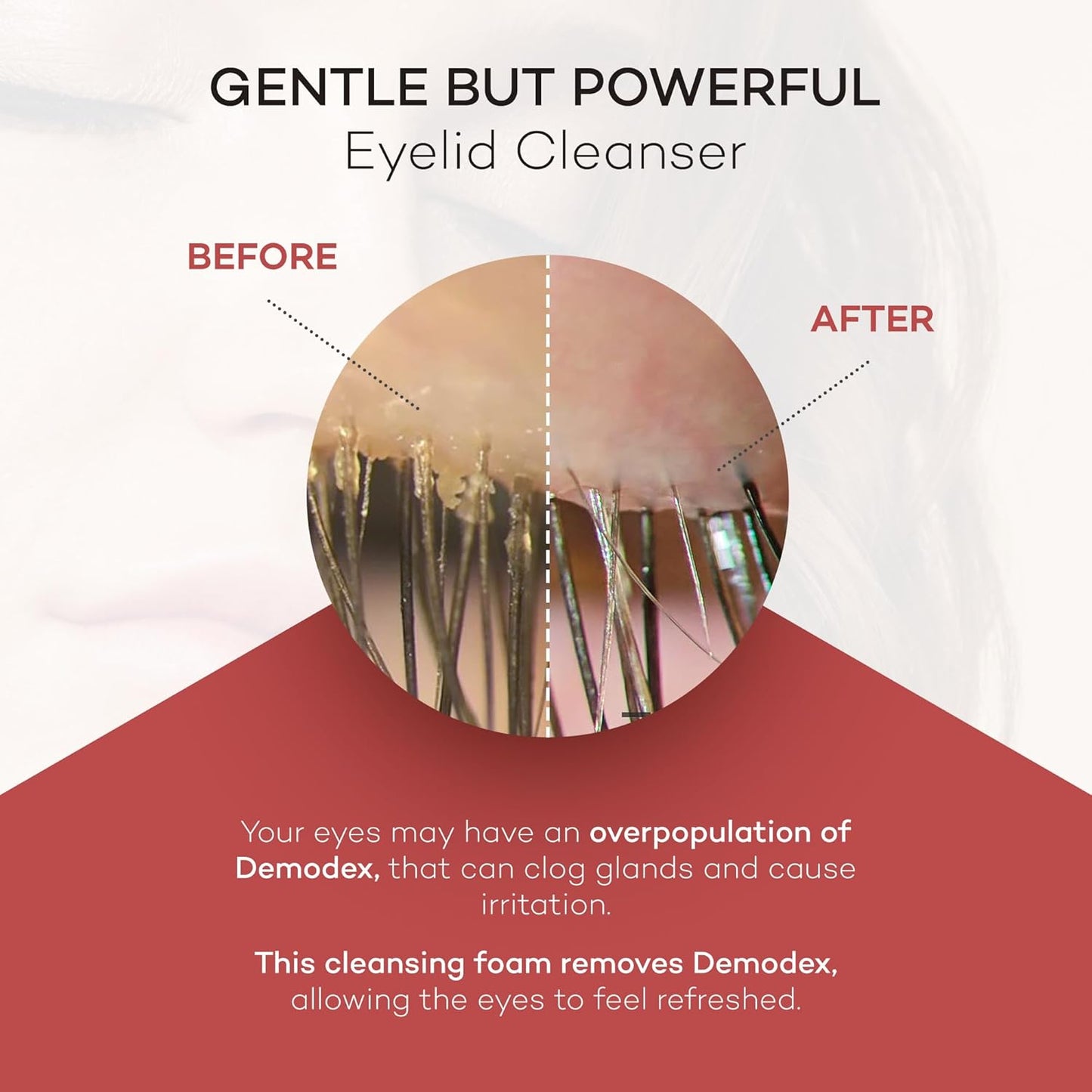 ZocuFoam Eyelid Cleanser - Foaming Eyelid Scrub - Natural pH Balanced Solution - 25mL