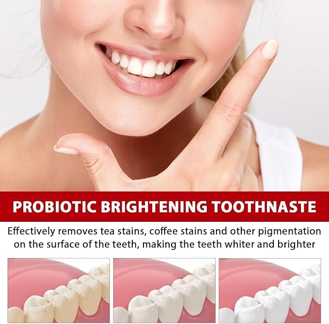 2Pcs Sp-6 Ultra Whitening, Sp-6 Probiotic Whitening Toothpaste, Deep Cleaning Care Toothpaste 120g