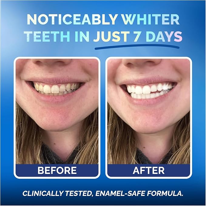 Whitening Strips for Sensitive Teeth – Enamel Safe, Peroxide-Free Coconut Teeth Whitening Strips with Natural Enzymes – Gentle White Stips for Sensitive Gums (14 Count, Mint)