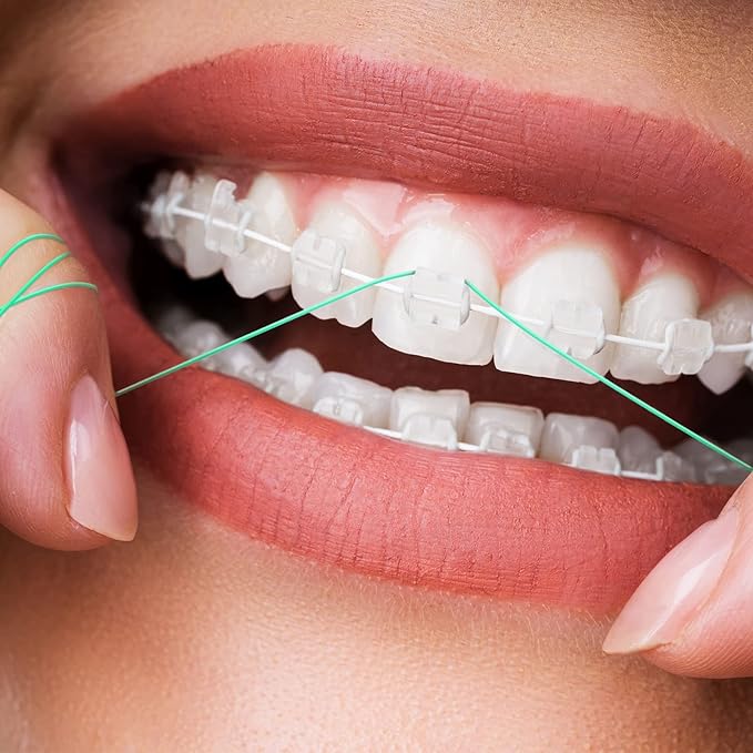 Vesici 600 Pcs Dental Floss Threader for Bridges, Braces, and Implants Dental Threader, Multifunctional Nylon Loop Design for Your Teeth, Pack of 12(Green)