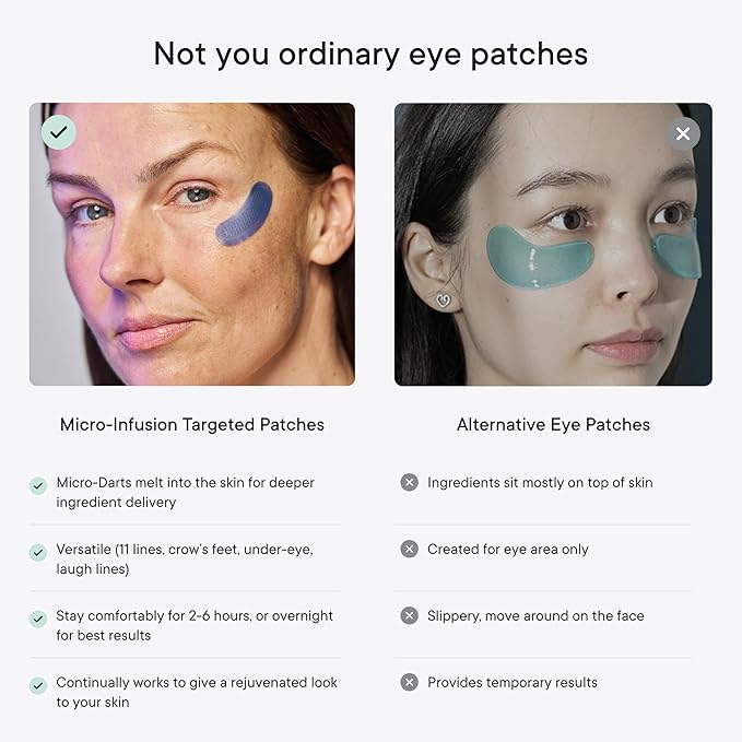 Qure Micro-Infusion Anti Wrinkle Patches for Smile Line, Frown lines, Under Eye Bags, Puffiness, Crow's Feet - Retinol, Caffeine, Niacinamide & Peptides - Dissolvable for Overnight Use - 24 Pairs