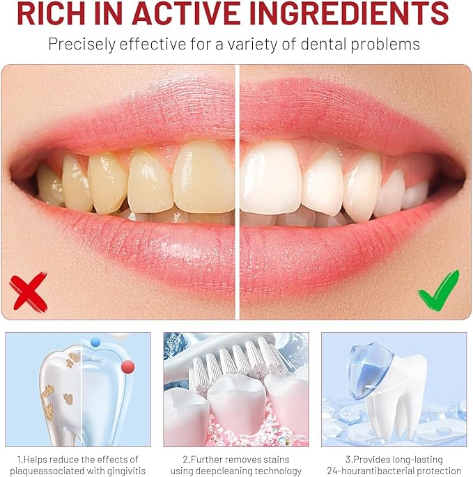 SP10 Probiotic Whitening Toothpaste Advanced Oral Care, SP 10 Teeth Whitening Paste Fresh Breath, Deep Cleaning, Stain Removal– Natural Formula (2 Pack)