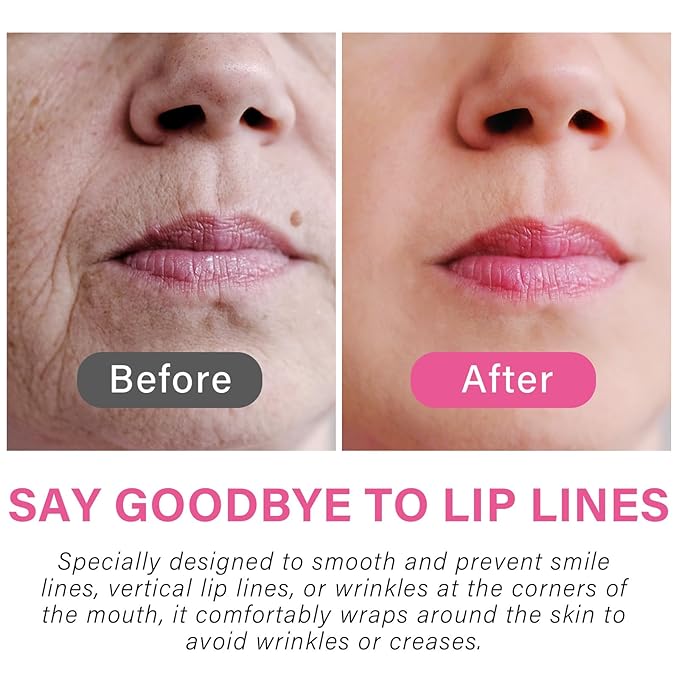 Anti Wrinkle Patches for Lip, Smile Line Patches, Overnight Smoothing Anti-Wrinkle Face Patches for Smile Line & Lip Area, 6 Pcs