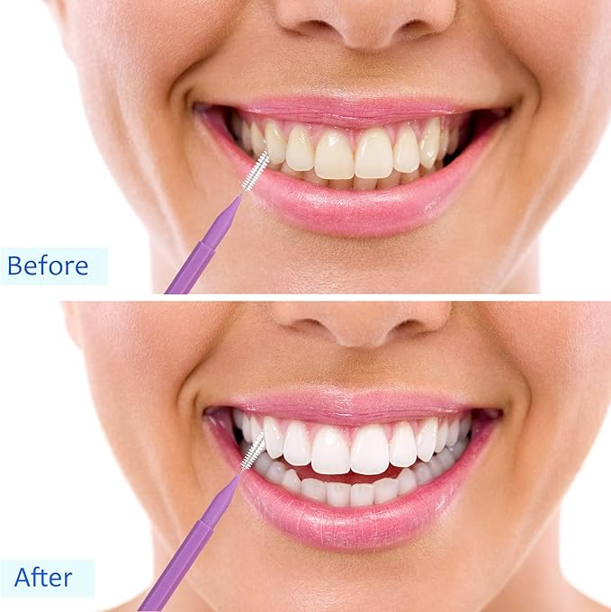 Patelai 50 Pieces Interdental Brush for Cleaner Braces Brush Toothpick Dental Tooth Flossing Head Oral Dental Hygiene Flosser Toothpick Cleaners Tooth Cleaning Tool(Purple)