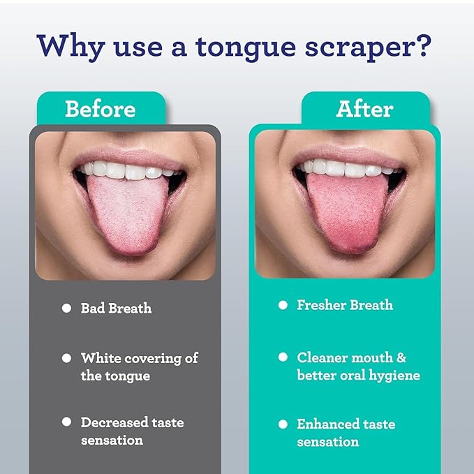 GuruNanda Tongue Scraper for Adults (2 Pack) with Travel Case, 420 Medical-Grade 100% Stainless Steel Tongue Cleaner, Aids in Fresh Breath & Oral Care