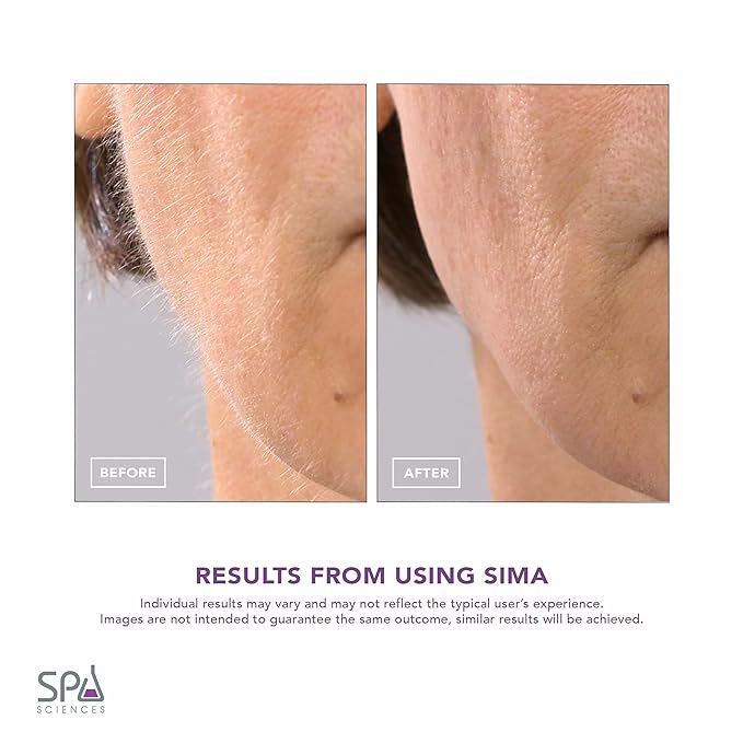 SPA SCIENCES - SIMA Patented Dermaplane Razor for Women Face – Painless 2-in-1 Facial Exfoliation & Peach Fuzz Hair Removal – Anti-Aging – 3 Speeds – Rechargeable – 7 Weeks Treatment