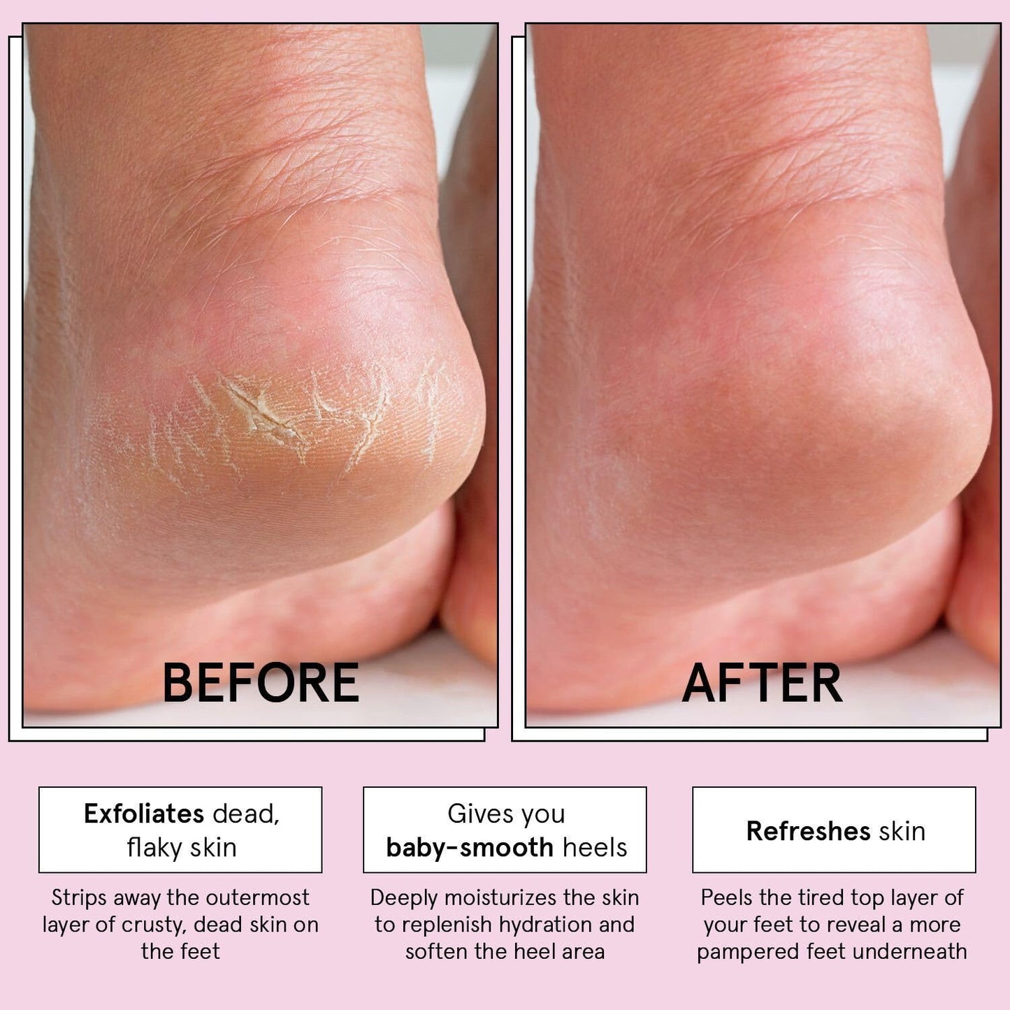grace & stella Award-Winning Foot Peel Mask - Foot Peeling Mask with Aloe Vera - Moisturizing Foot Mask for Dry Cracked Feet - Foot Exfoliator for Baby Soft Feet (4 Pairs, Lavender)
