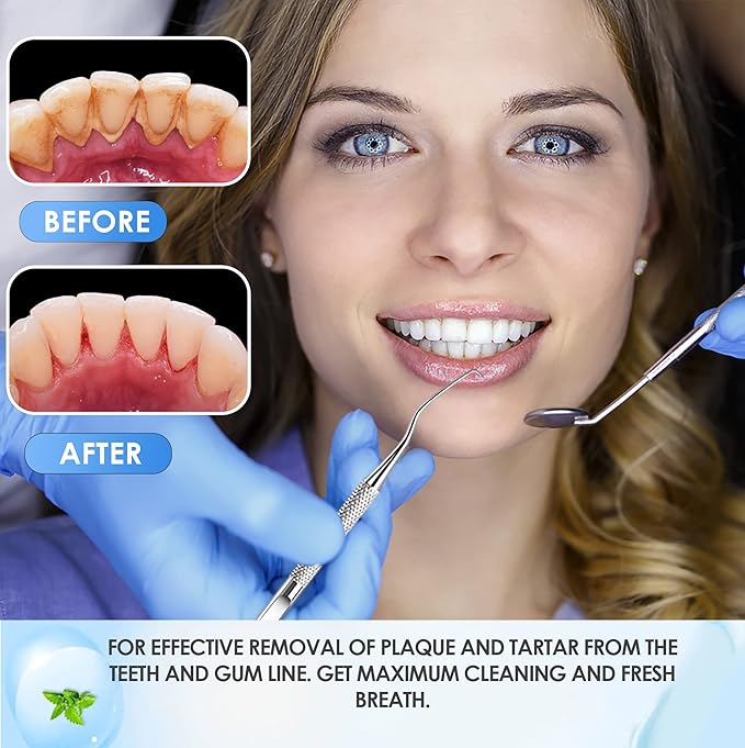 GTEX Dental Tools, Dental Pick, Plaque Remover for Teeth, Teeth Cleaning Tools, Plaque Tartar Remover for Teeth, Dental Picks for Teeth Cleaning, Teeth Cleaning Kit, Dentist Tools