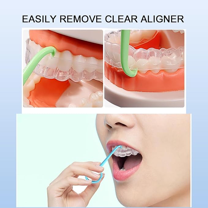 5PCS Aligner Removal Tool,Black Clear Aligner RemoverTools for Invisalign Removable Retainers, Aligners,Braces Removal Kit (5PCS Black)