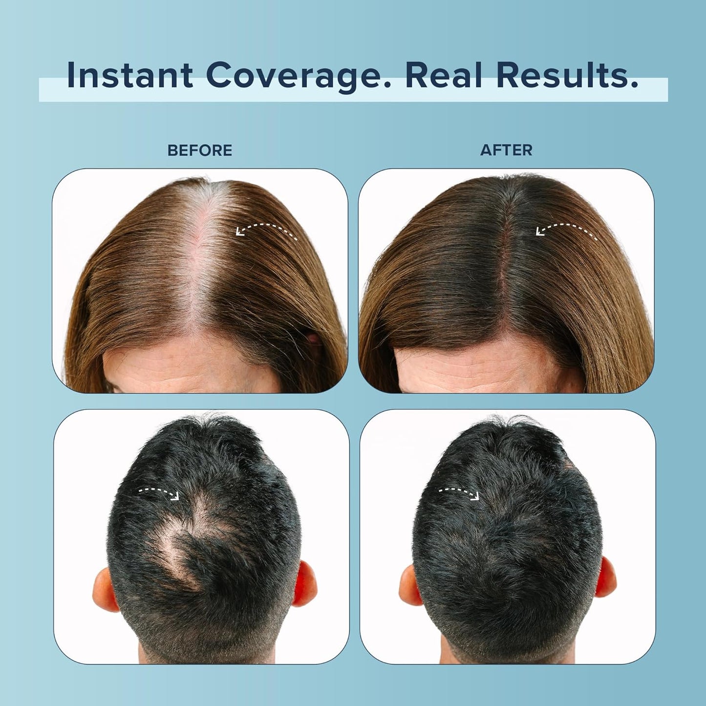 TRUHAIR Color Fibers Root Coverage & Density Booster | Quick-Apply Touch Up Hair Color | Natural Matching, Gray Hair Cover Up - 11 Colors Available (Black)