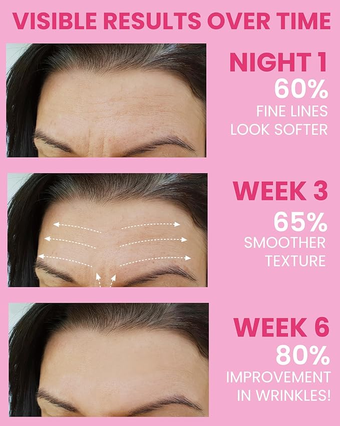 Akissos Facial Wrinkle Patches 80PCS Update Version Multi Area Anti Wrinkles Forehead Wrinkle Patches, Face Lift Tape for Wrinkles Overnight to Smooth Forehead Eyebrow Frown 11 Eye Smile Lines Lip