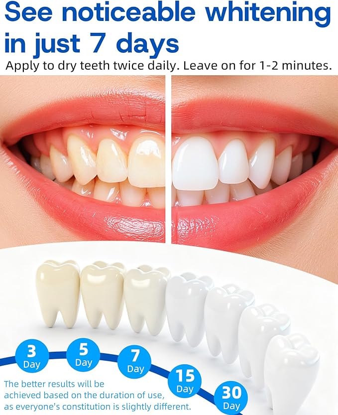 Teeth Whitening Pen 4 Pcs, 35% Carbamide Peroxide Gel, Tooth Paint & Teeth Whitening Gel as Effective Tooth Whitener, Removes Tough Stains Coffee, Wine, Tea, Sensitive Teeth-Friendly, Travel-Portable